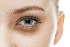 22 cách trị quầng thâm mắt hiệu quả nhất