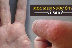 Cách làm thế nào để giải quyết vấn đề hiệu quả?