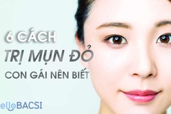 Cách làm xẹp mụn sưng đỏ không nhân sau 1 đêm