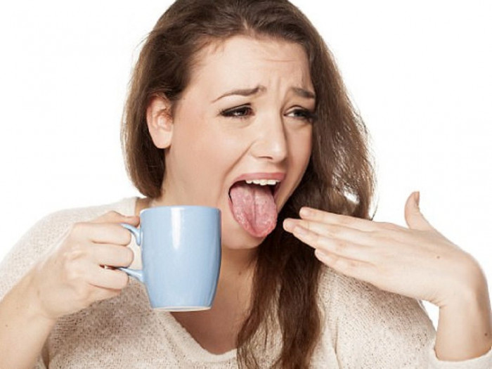6 cách giúp giảm cảm giác bỏng rát lưỡi khi ăn đồ quá nóng