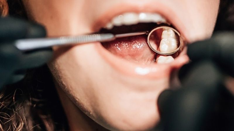 Đau răng nên làm gì? 18 mẹo giảm đau răng hiệu quả tại nhà - SESOMR